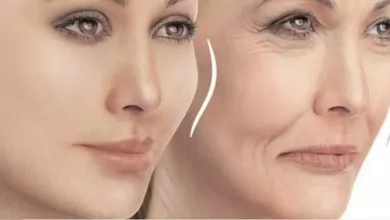 عوارض تزریق چربی به گونه‌ها