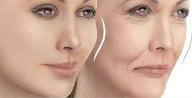 عوارض تزریق چربی به گونه‌ها