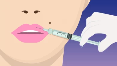 نحوه تزریق فیلر به لب چگونه است؟